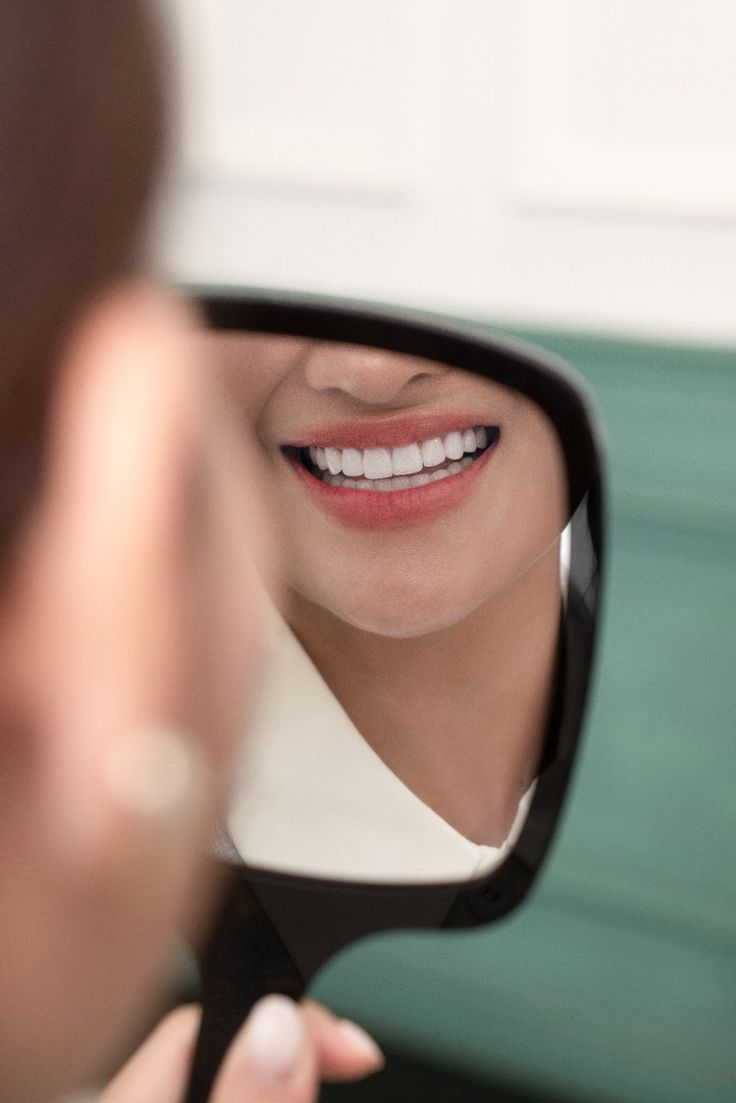 Final beautiful smile result from clear aligner treatment